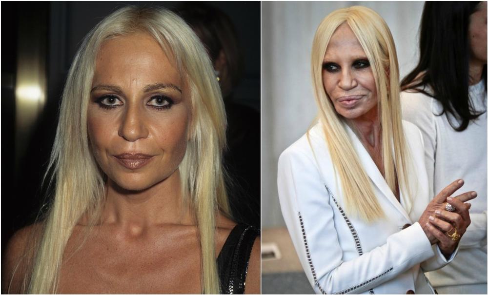 Queen of plastic surgery: Before destroying her face, Donatella Versace  looked like this (PHOTO) - Free Press