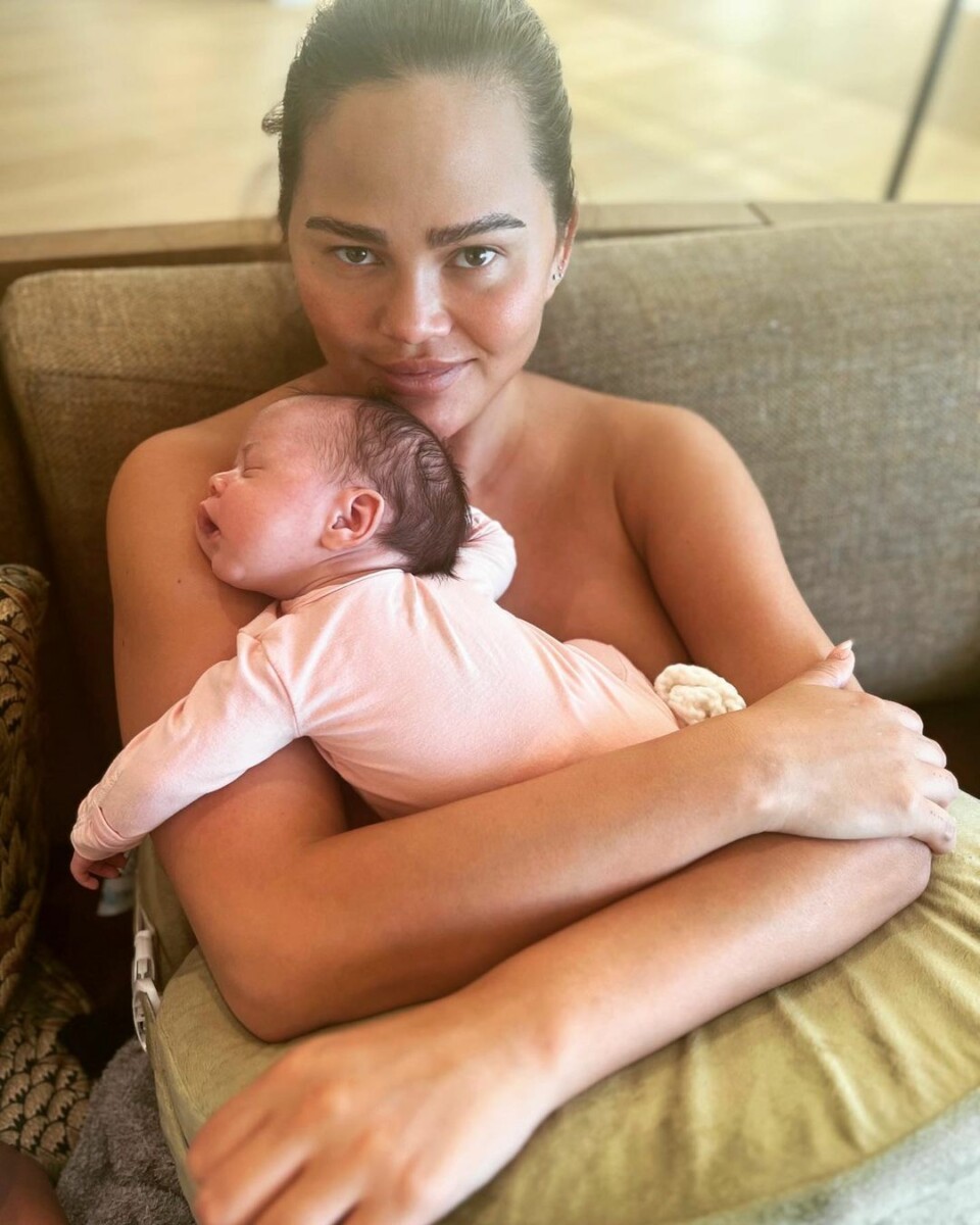 PHOTO  Hanging breasts and purple scars: Chrissy Teigen