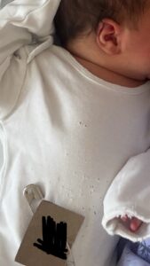 Уште едно бебе во боди со дупки на ГАК